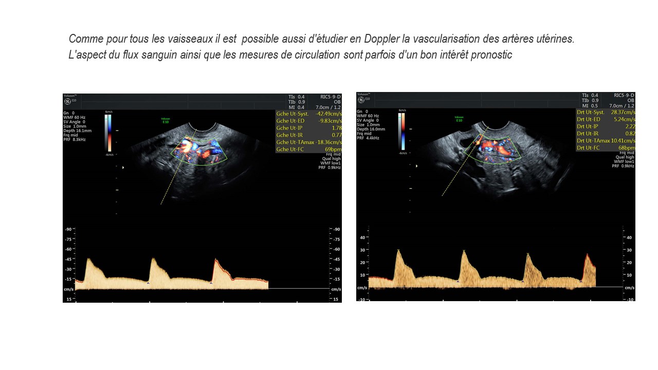 BILAN4