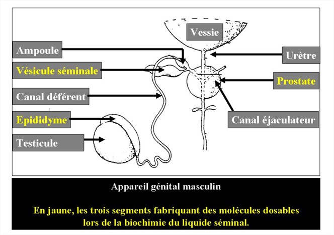 Infertilité masculine